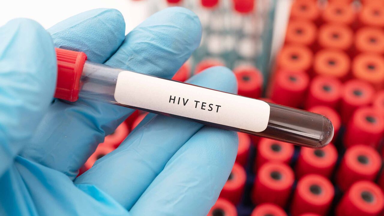 HIV