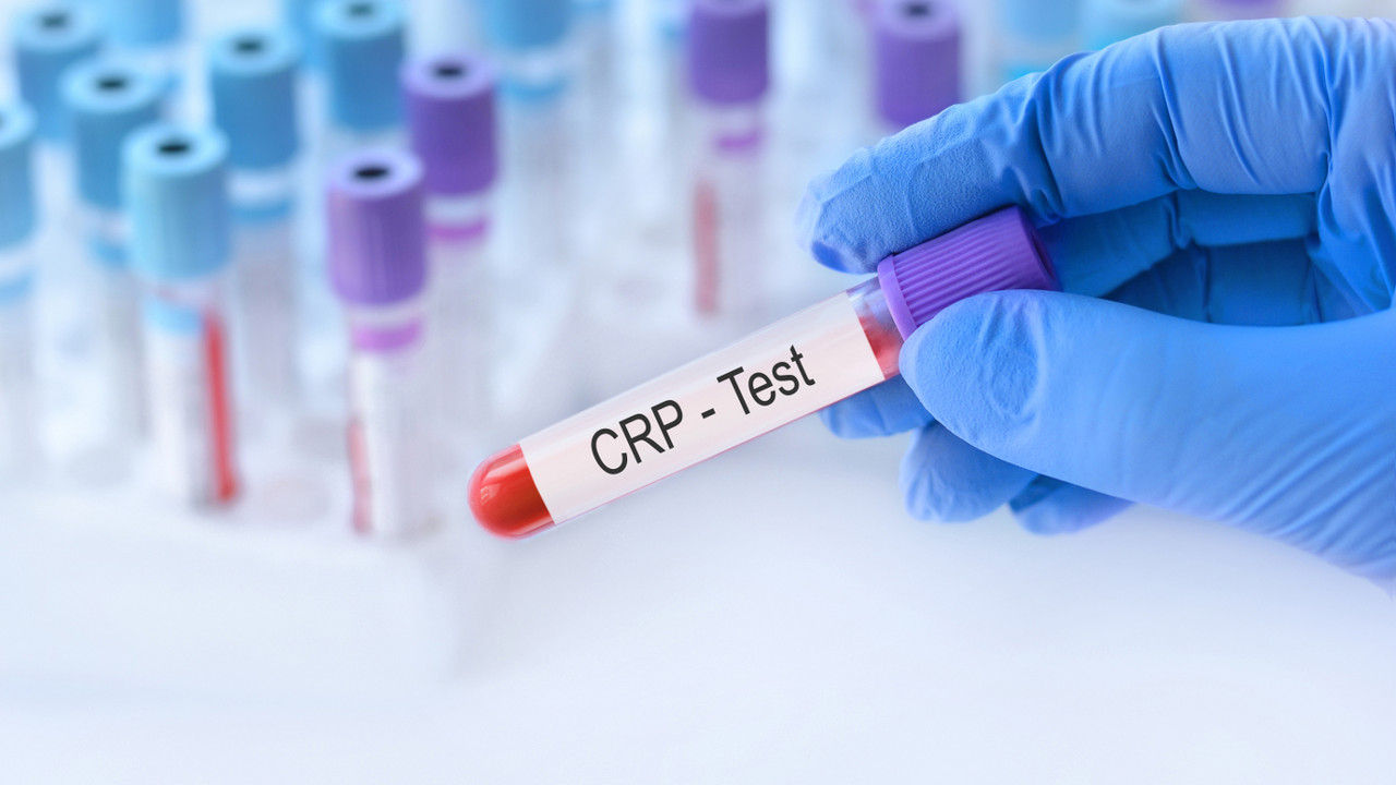 CRP