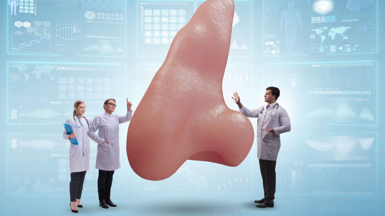 Nosevi