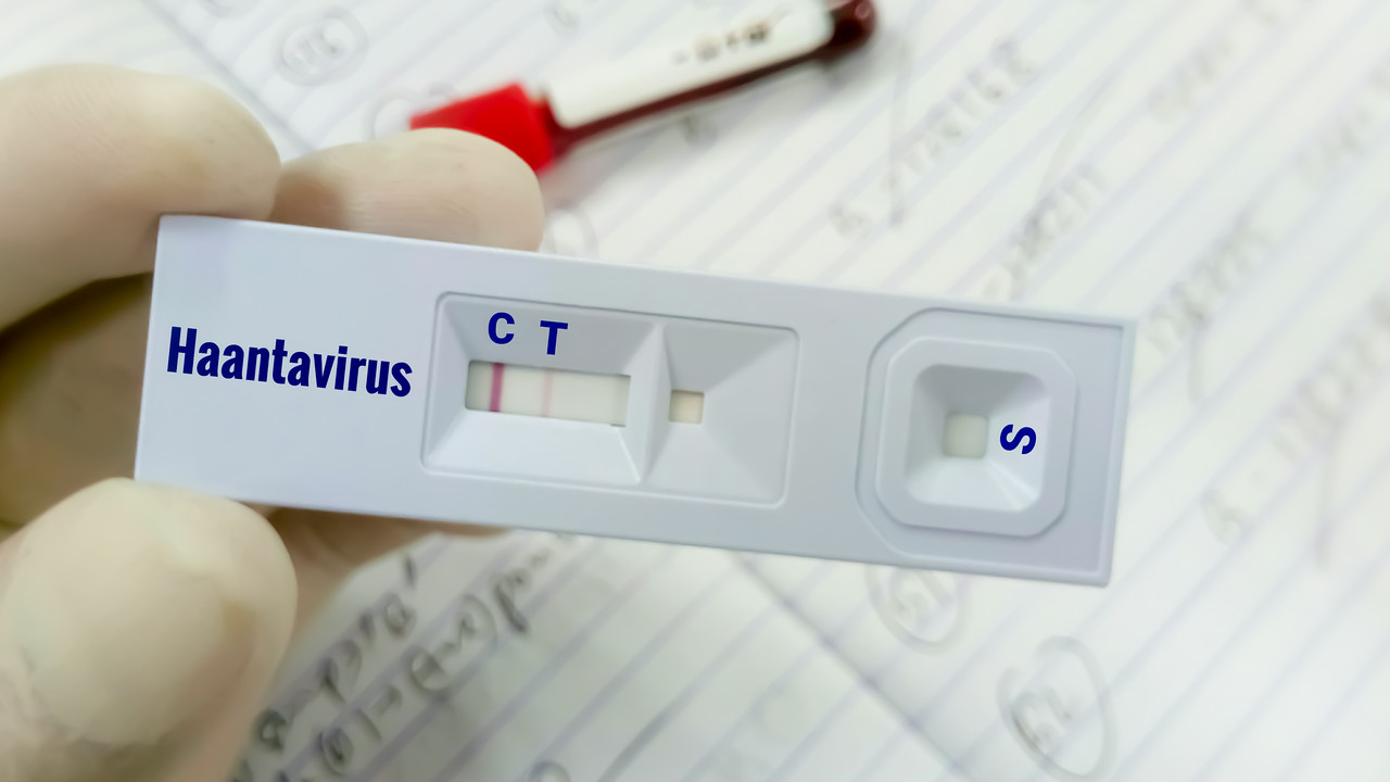 Hantavirus