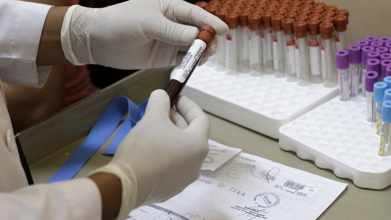 Zika virus