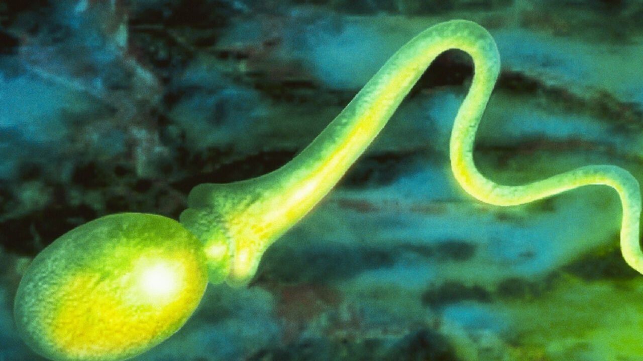 spermatozoid