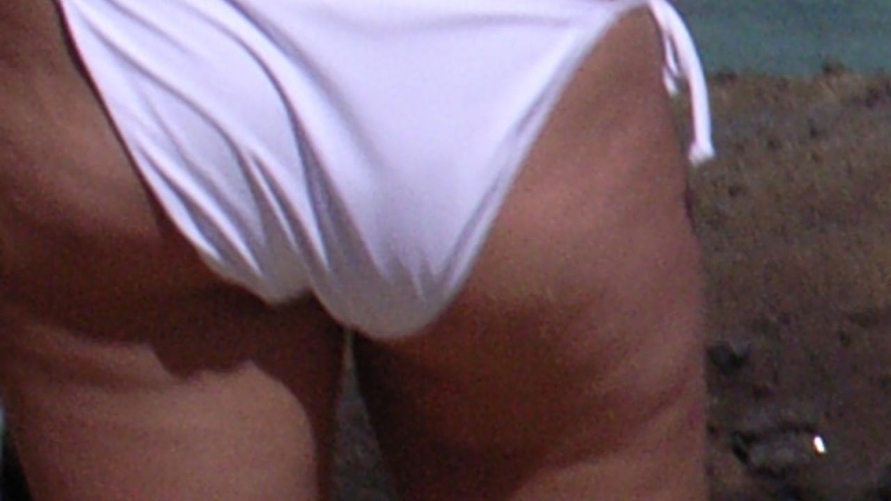 celulit 