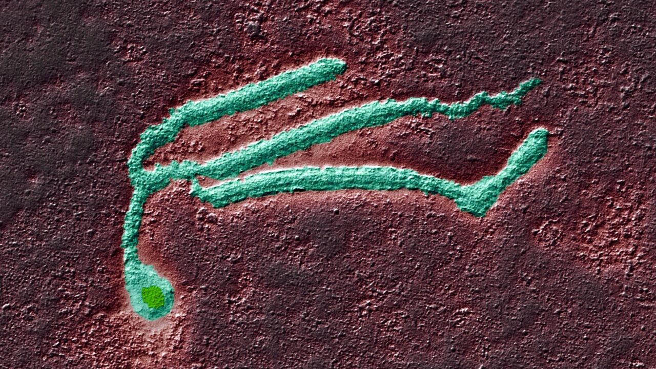 Virus ebole pod mikroskopom