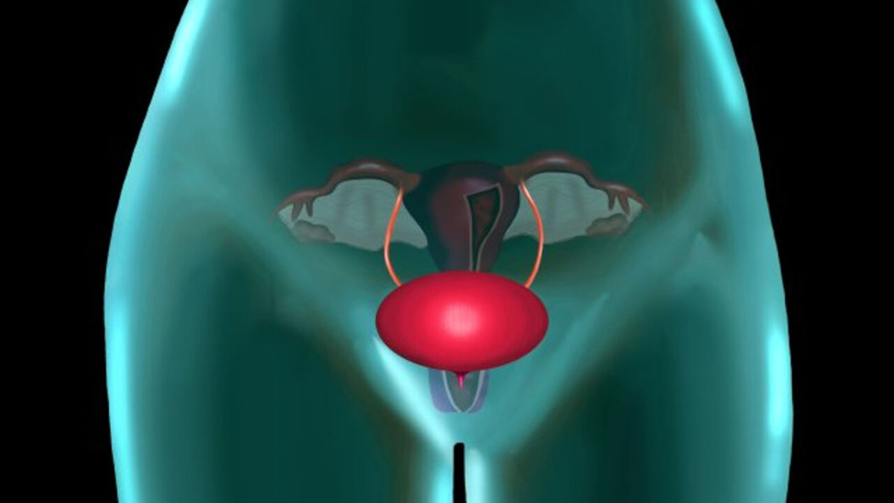 materica