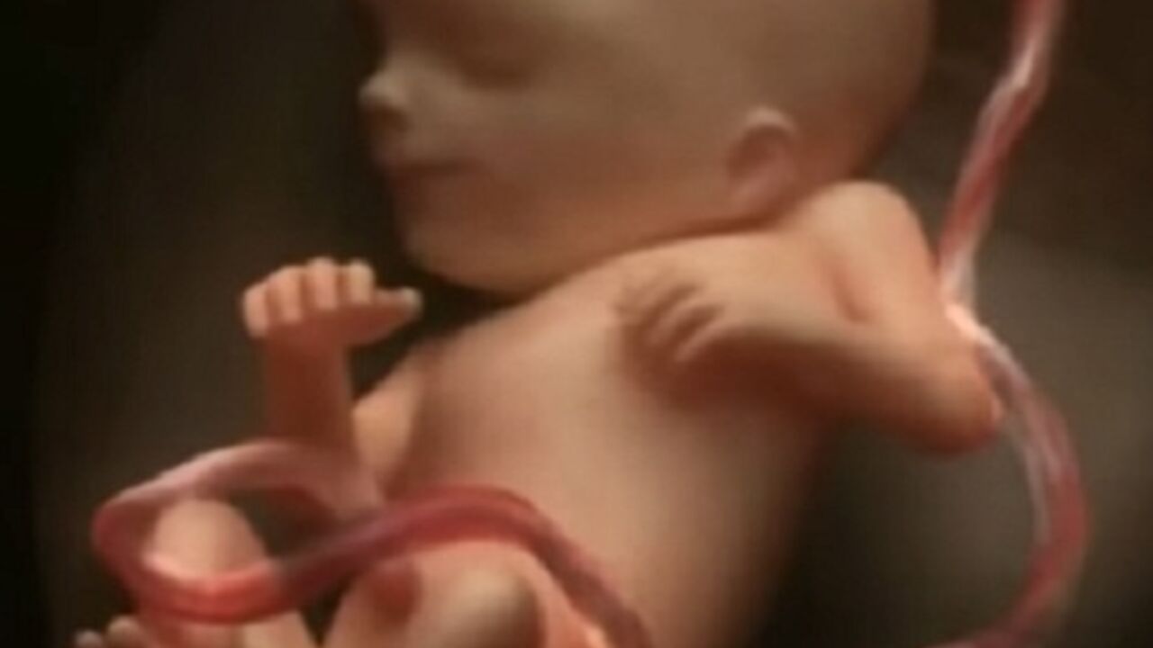 fetus