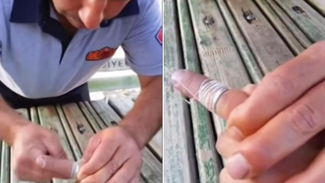 Skidanje prstena sa prsta pomoću konca