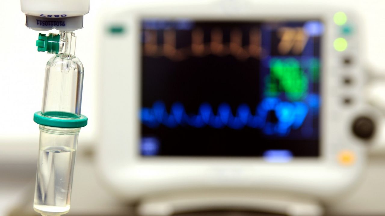 EKG i infuzija