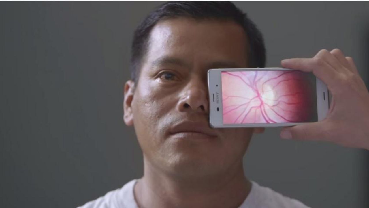 Peek Retina