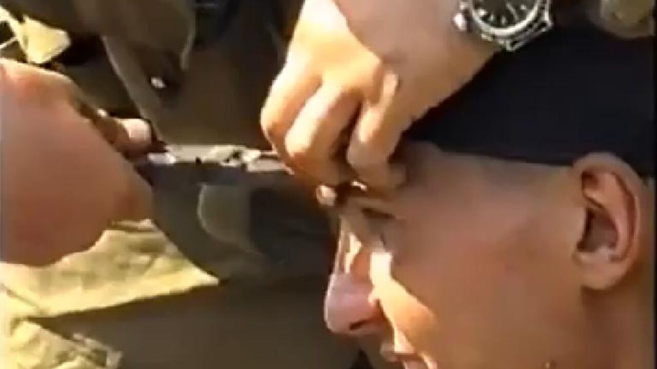 Metak u čelo