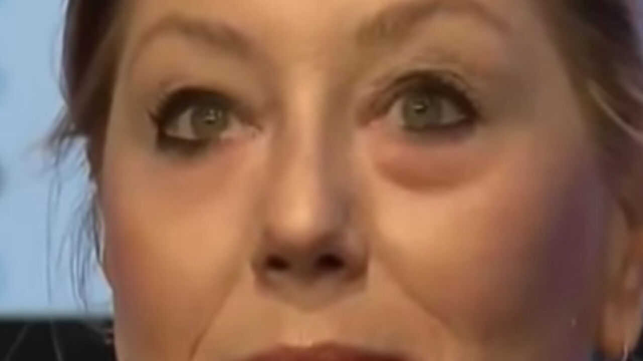 oči