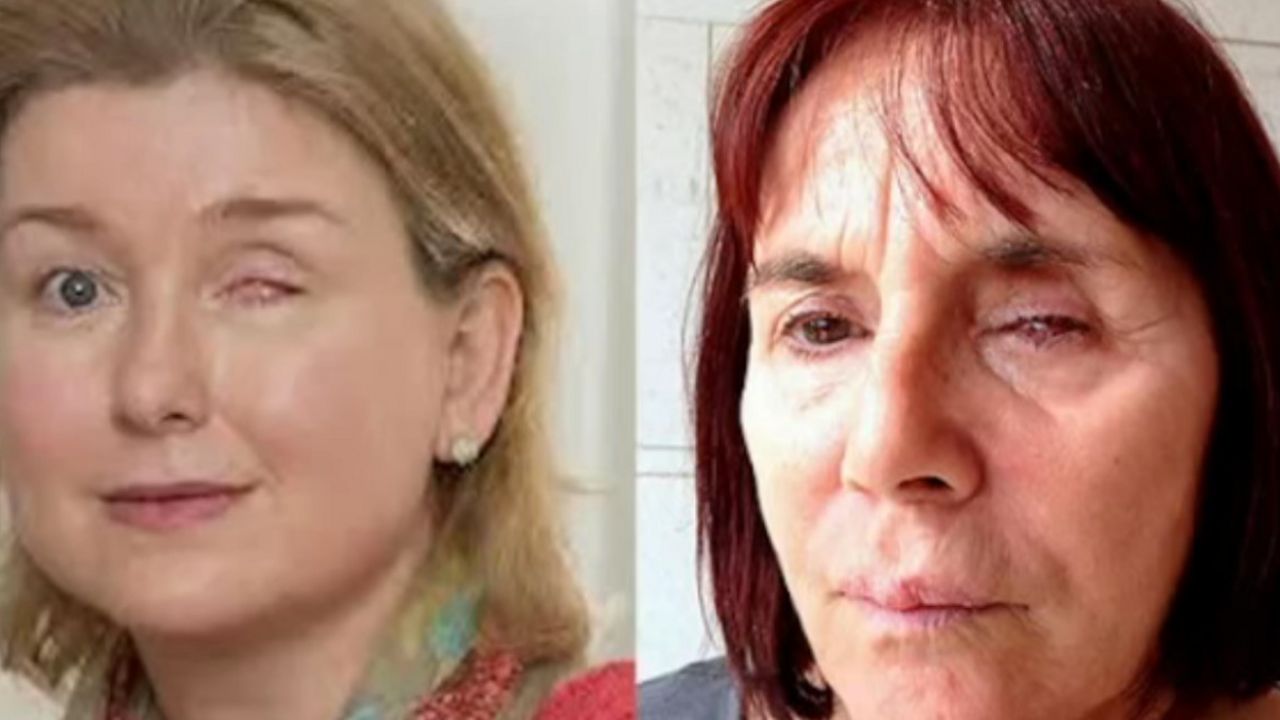 infekcija očiju