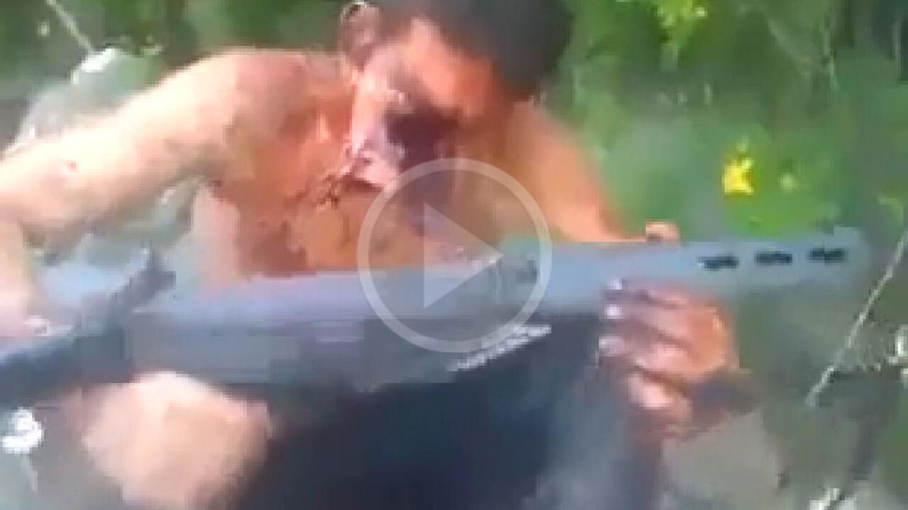 Razoreno lice nakon nesreće sa puškom