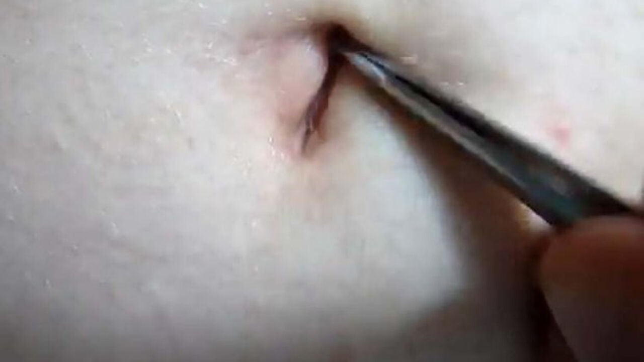 Pupak