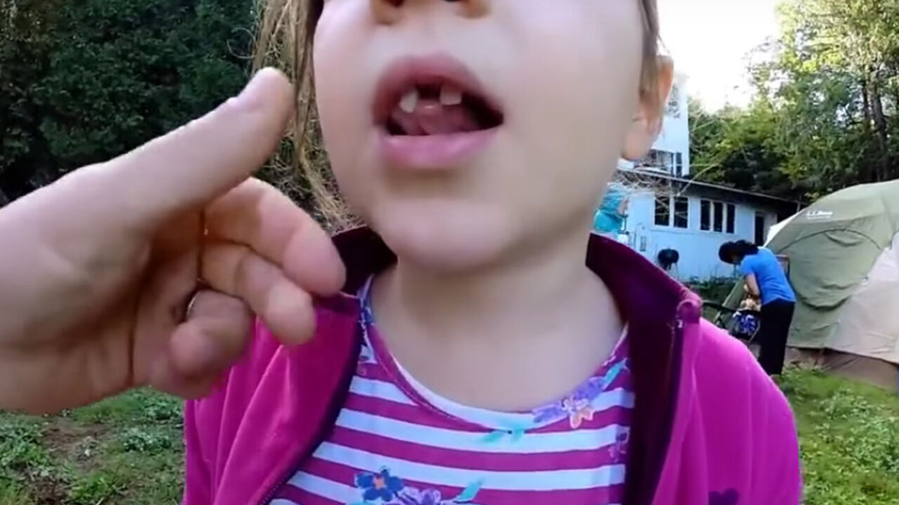 devojčica bez zuba