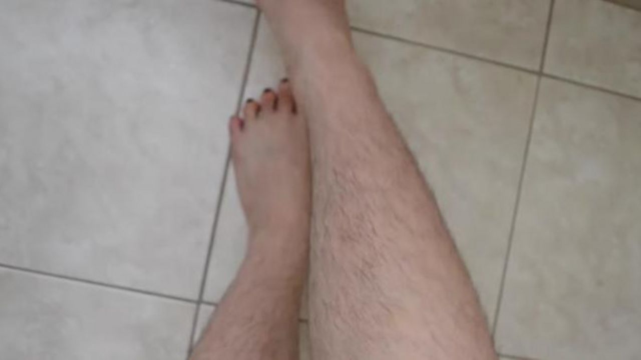 dlakave noge