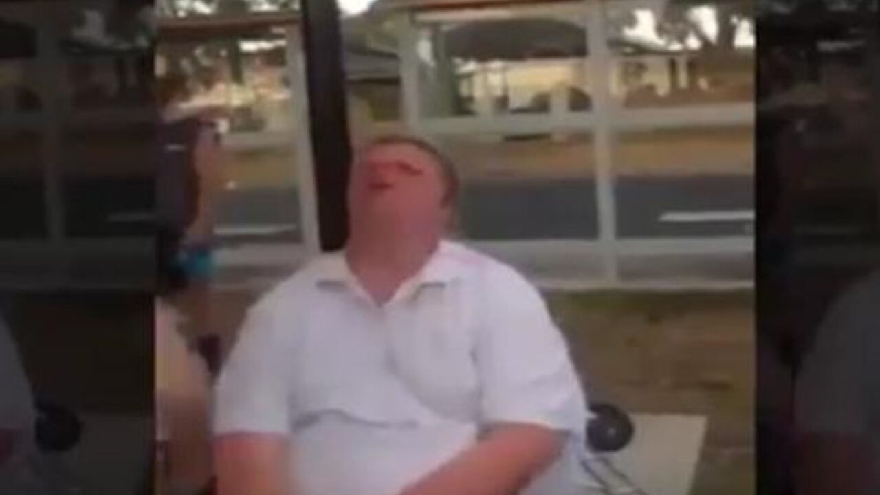 dečak sa daunovim sindromom