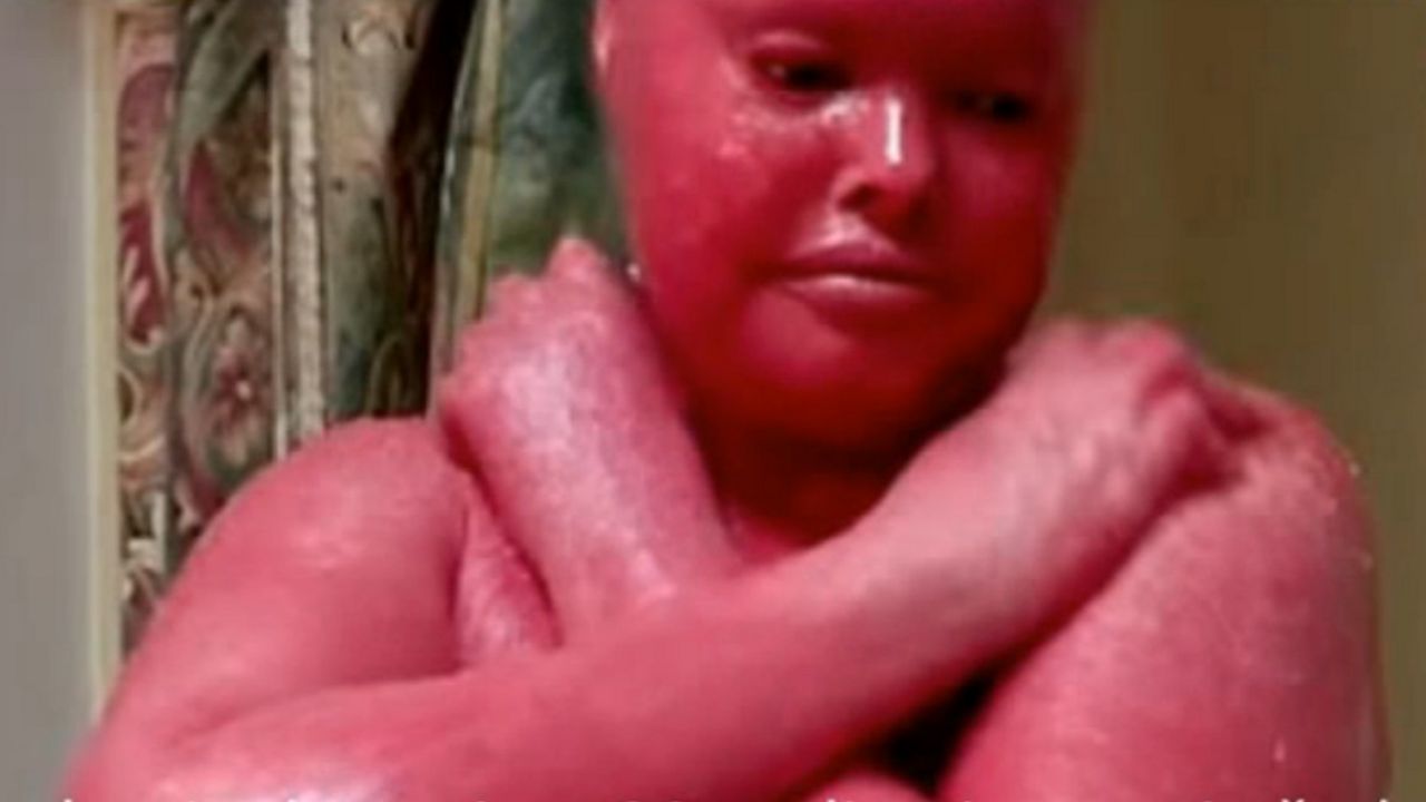 devojka sa ružičastom kožom