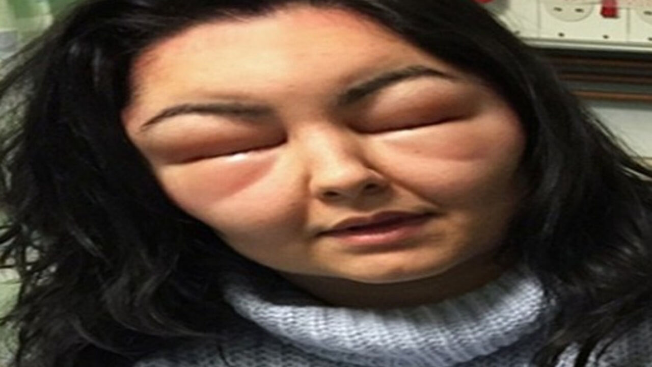 žena sa očima
