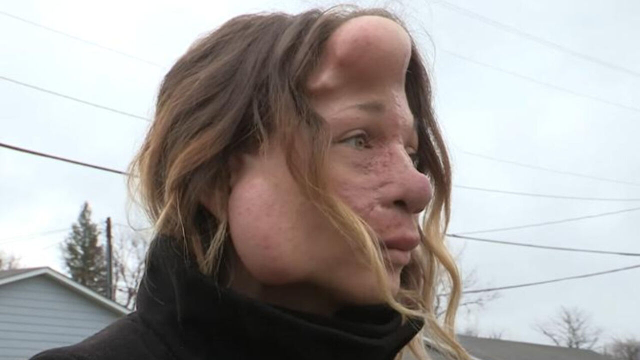 izobličena žena