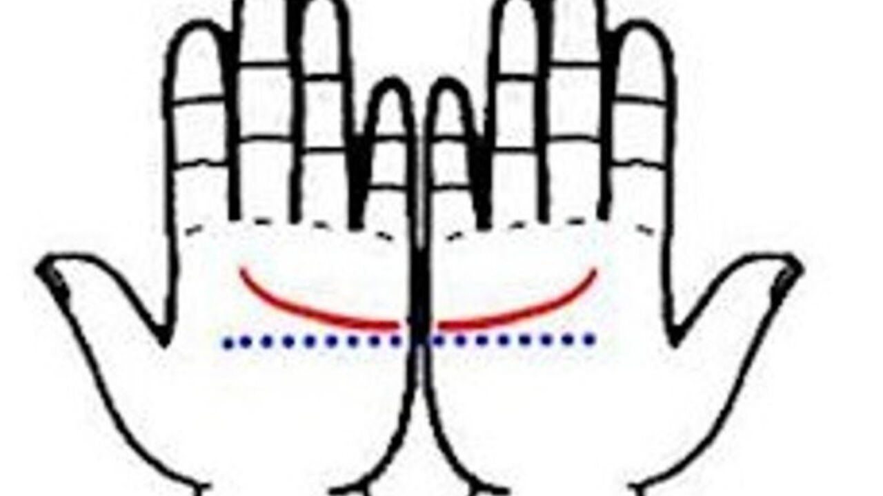 dlanovi