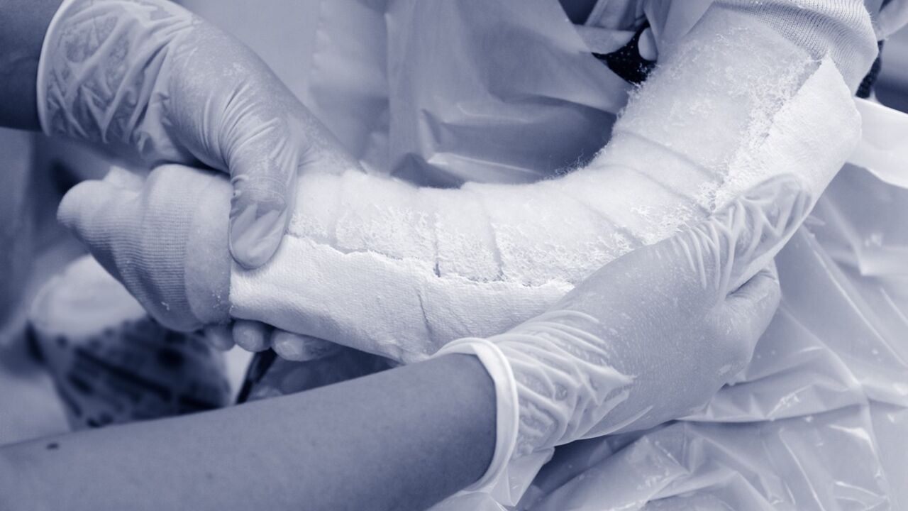 Gips