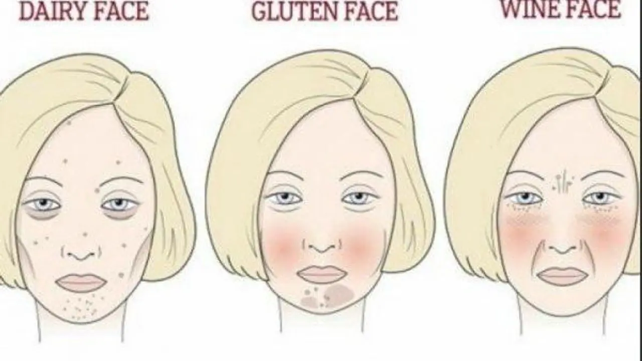 Tolerancija na alkohol, gluten i šećer