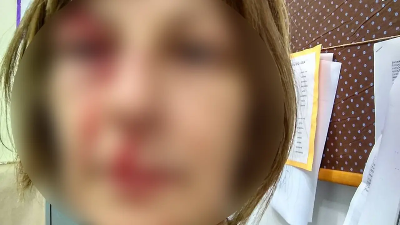 pretučena profesorka 