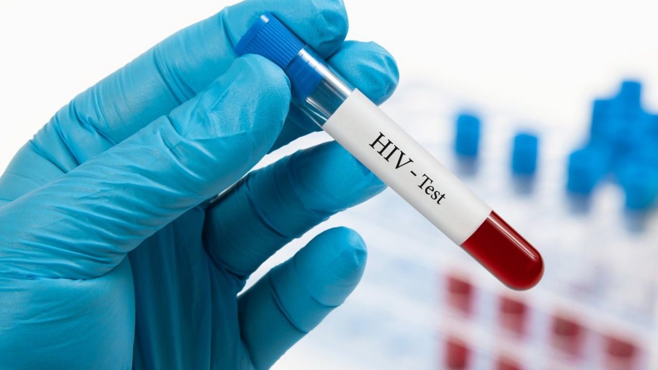 hiv test