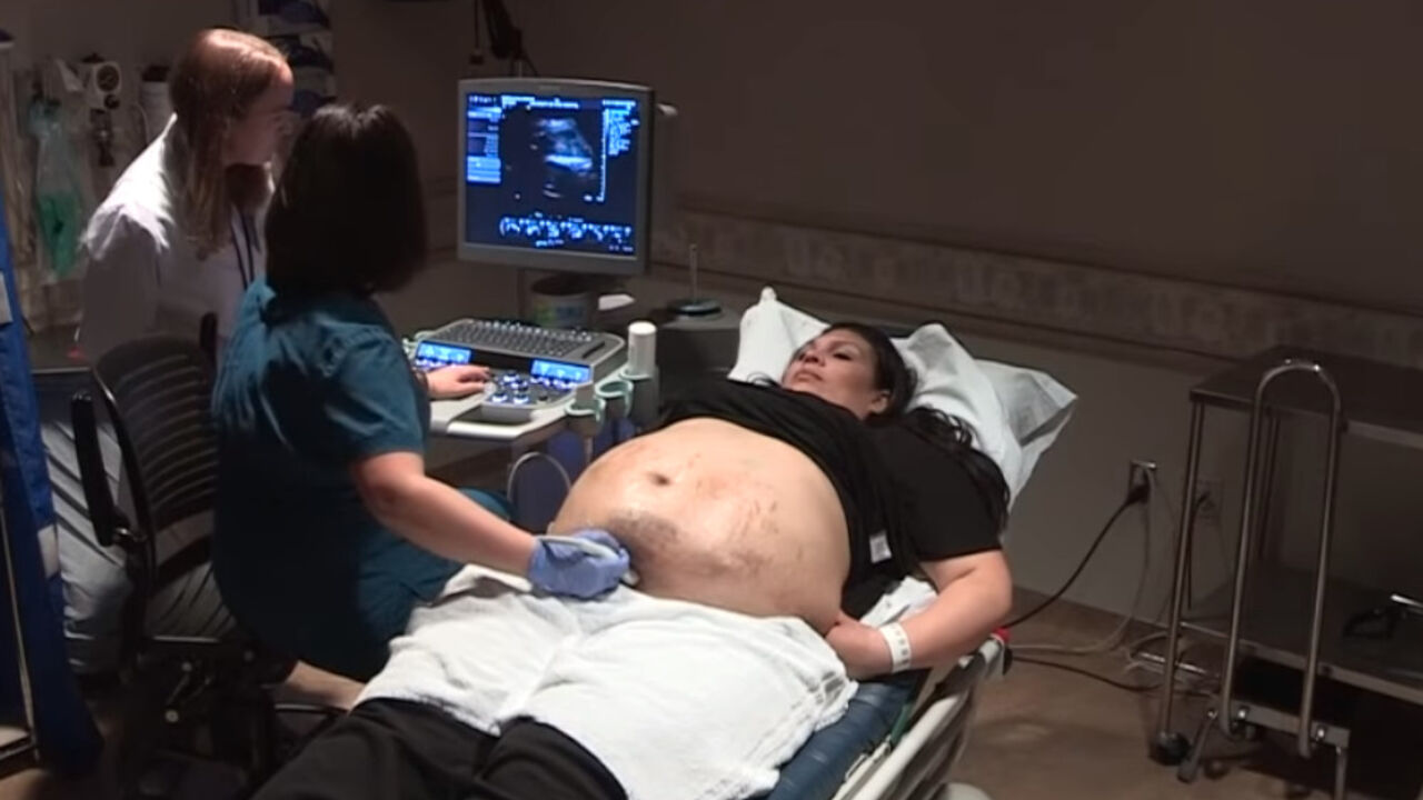 Foto: Youtube/Printscreen/U of U Health