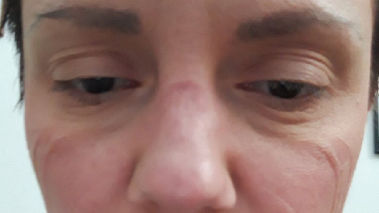 anesteziolog