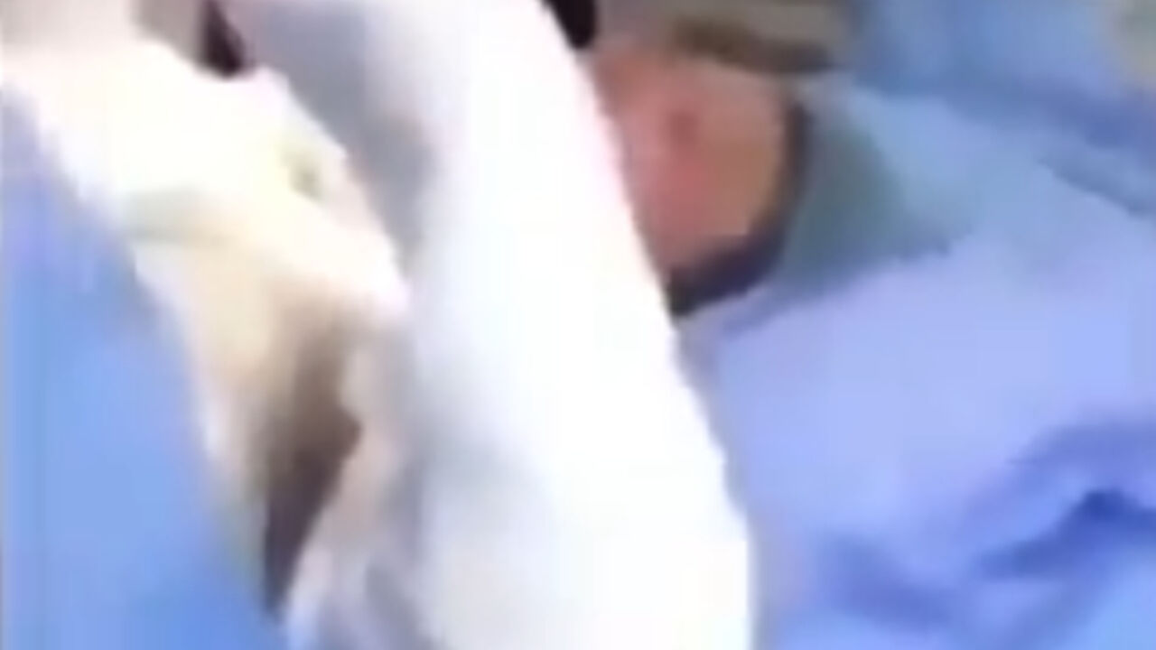 Žena sa opekotinama