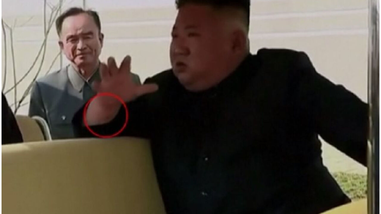 Kim Džong Un