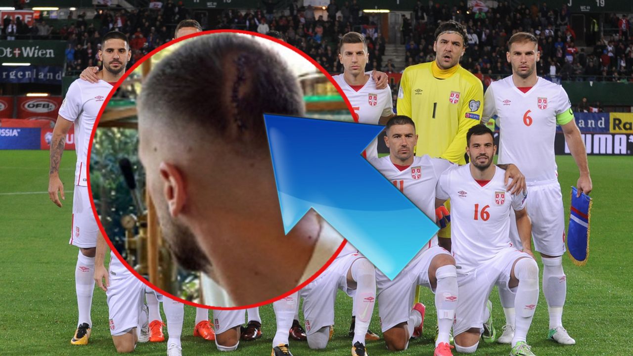 Povreda Matije Nastasića