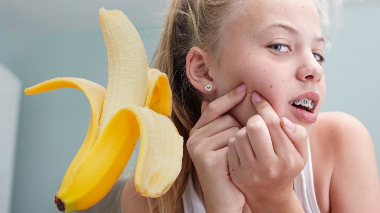 banane