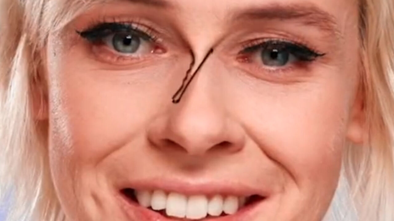 ukosnica