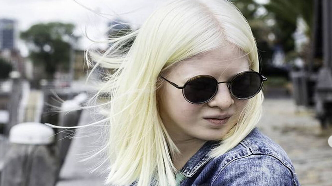 albino manekenka