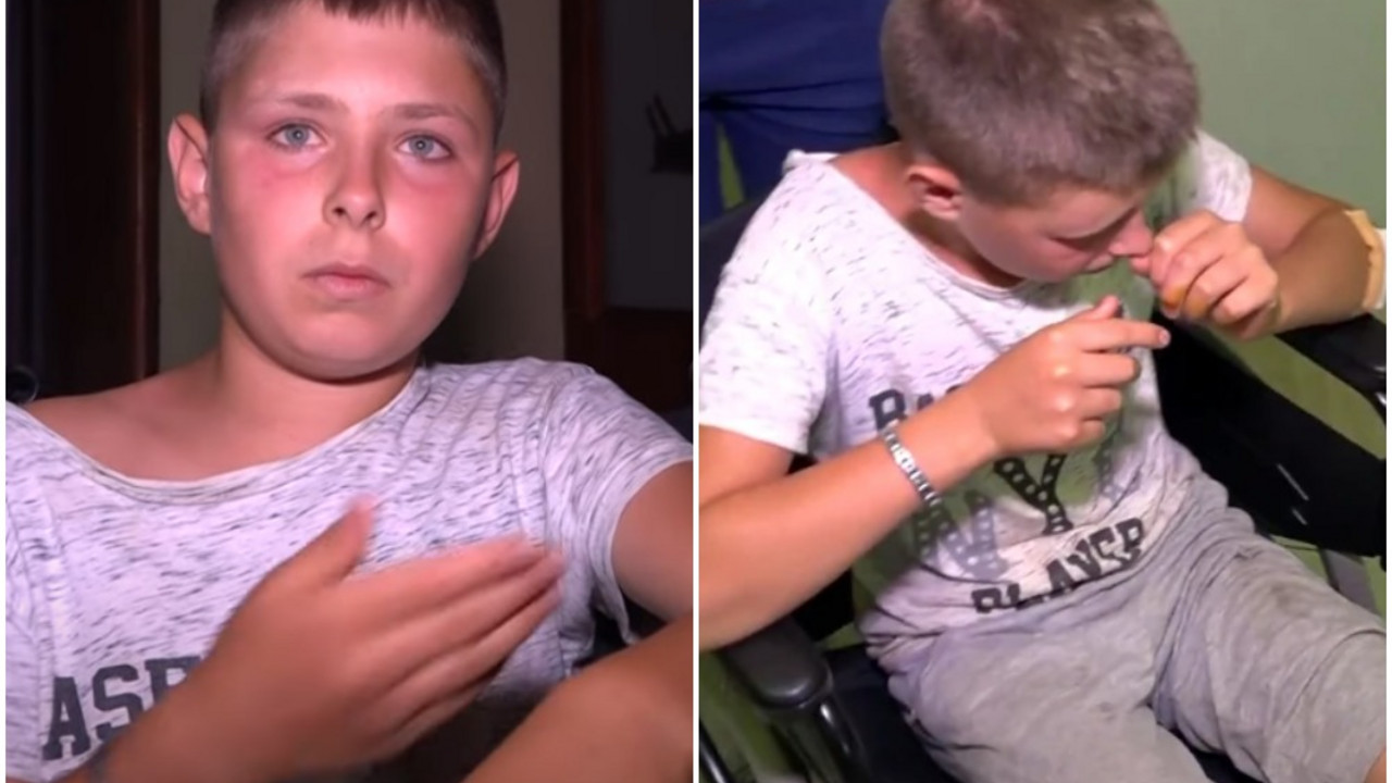 Prebijeni dečak kod Gojbulja