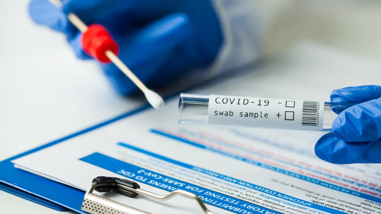pcr test