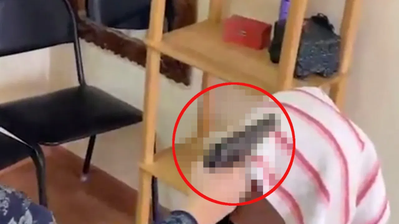 Bizarna metoda lečenja