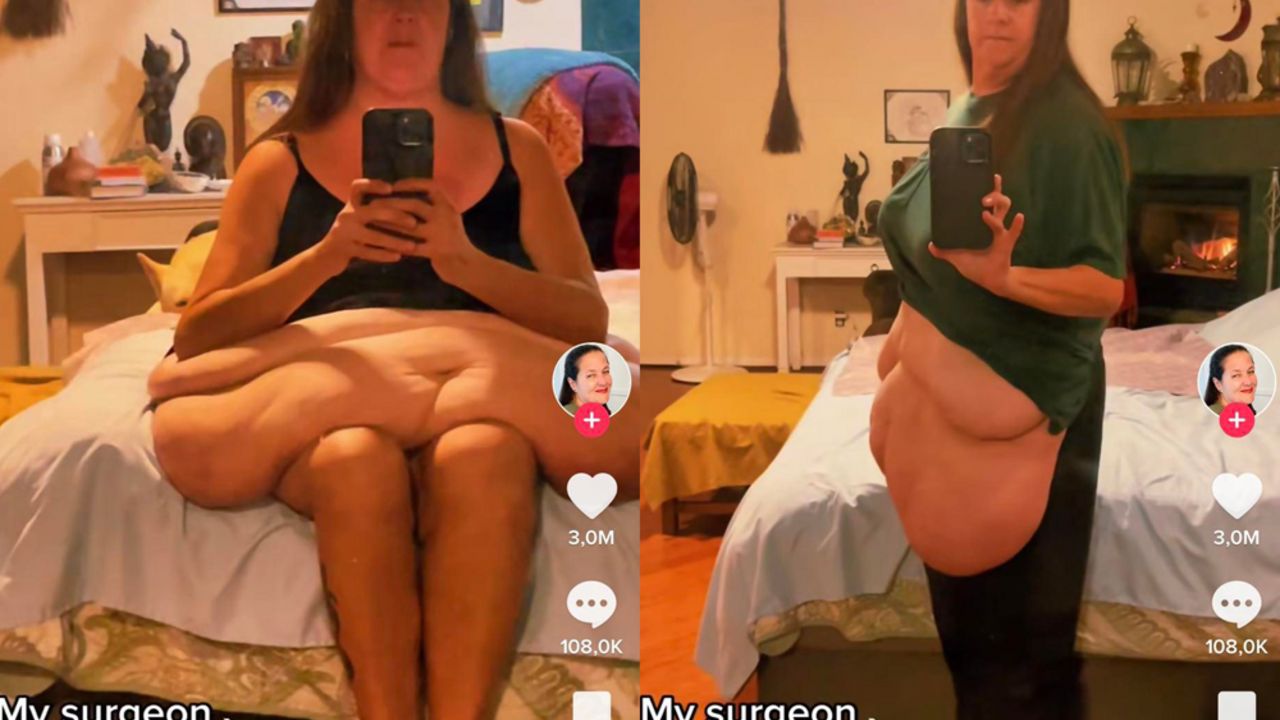 Teresa (44)