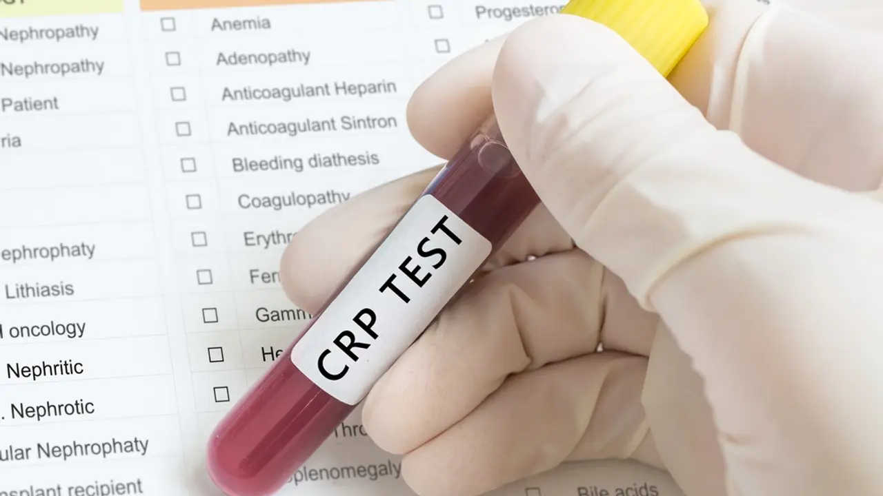 crp