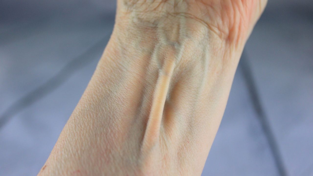 Palmaris longus