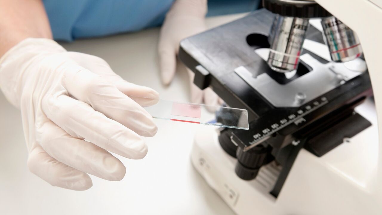 Laboratorijska analiza